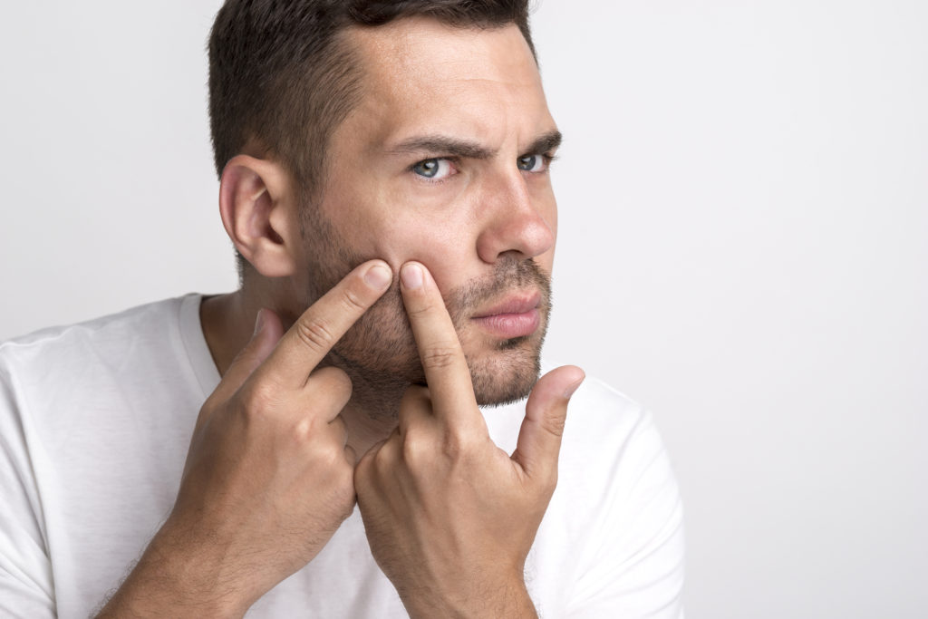 5 hábitos que dañan tu piel