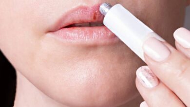 PORTADA Herpes labial