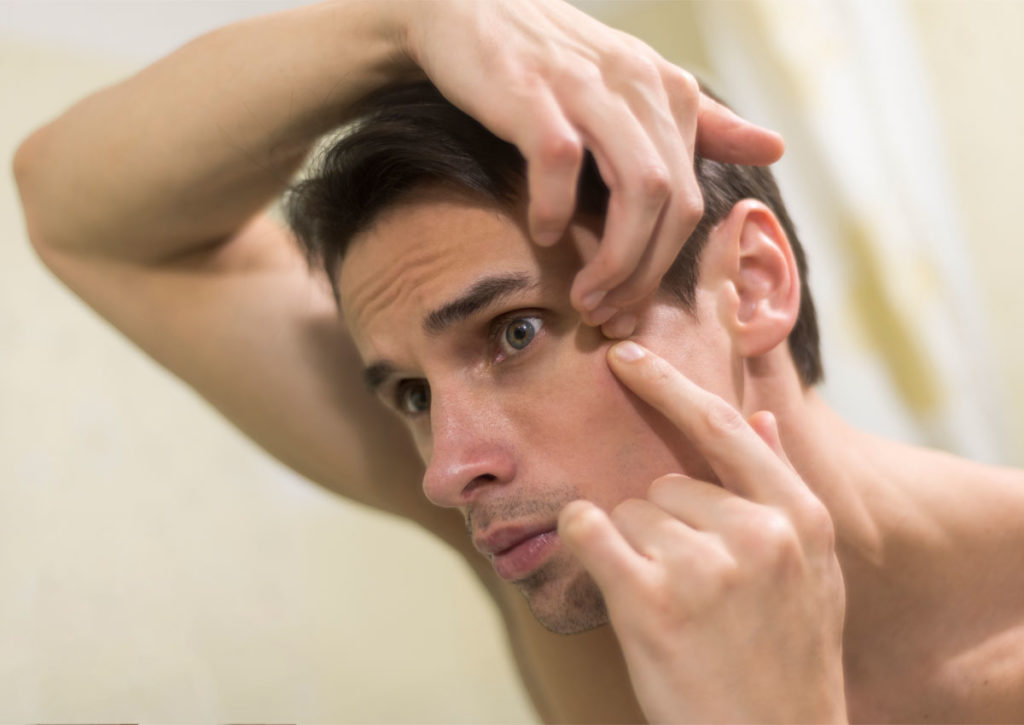 Clear Skin Basics Skindermis