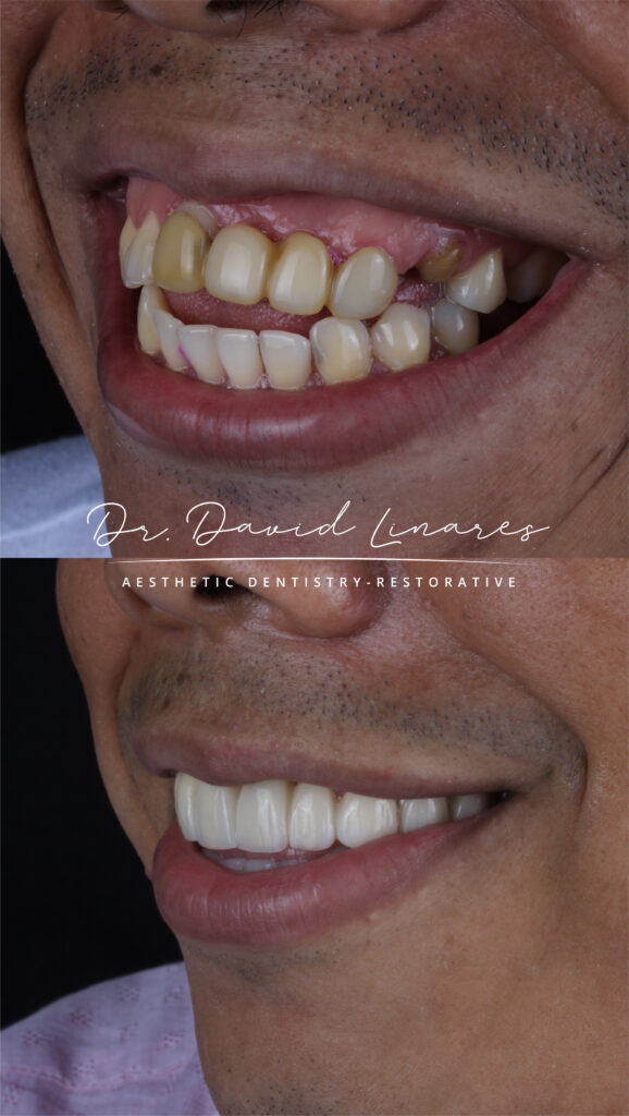 lumineers David Linares