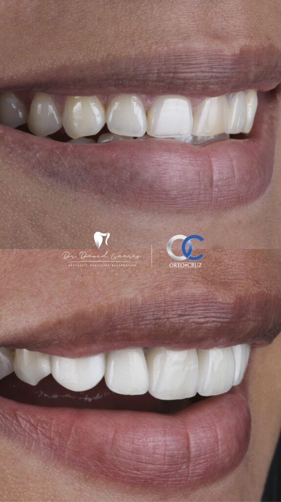 lumineers David Linares