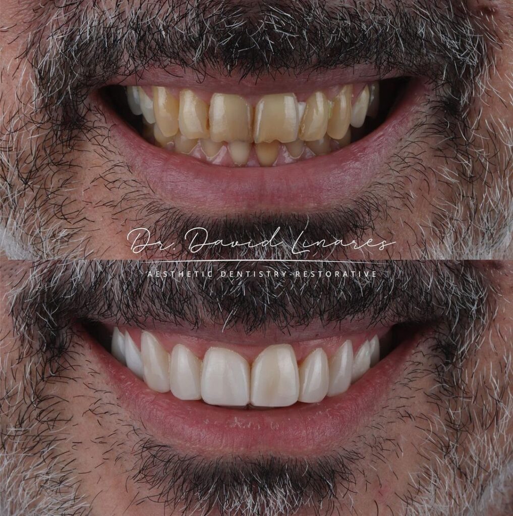 Antes y después de la sonrisa by David Linares