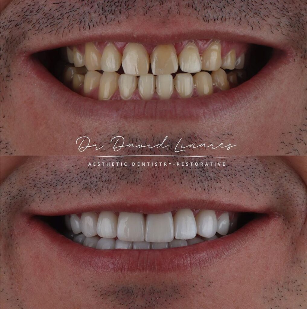 Antes y después de la sonrisa by David Linares