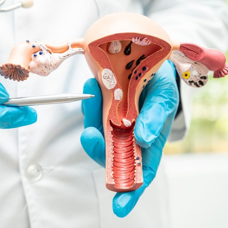 cáncer del cuello uterino