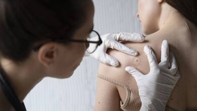 Cuidados y recomendaciones para Varicela