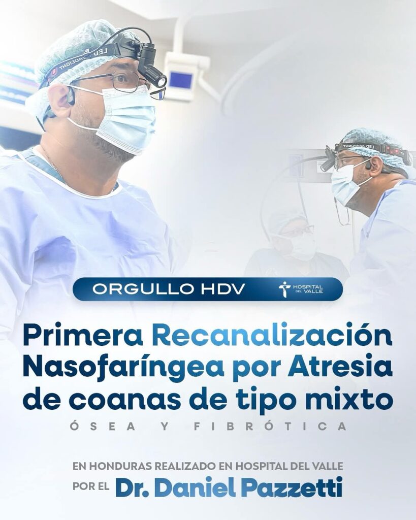 Recanalización nasofaríngea 2025 Hospital del Valle Honduras