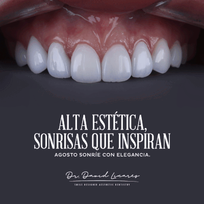anuncio David Linares